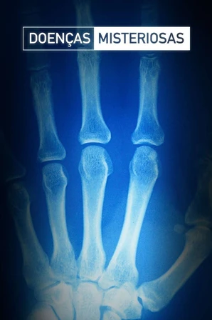 Doenças Misteriosas